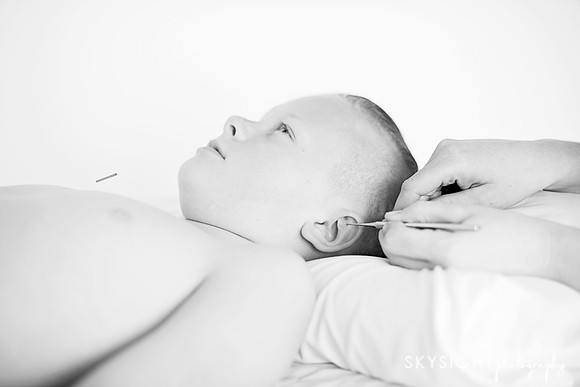 truhealthfit_acupuncture_123