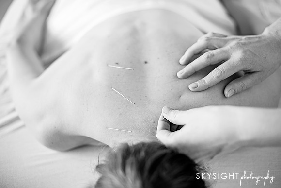 truhealthfit_acupuncture_043