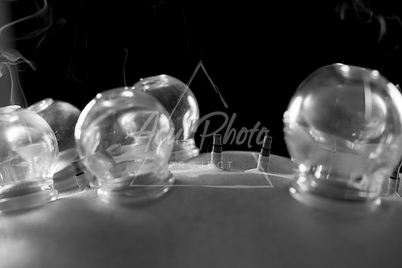 acupuncture-277