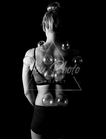 acupuncture-287