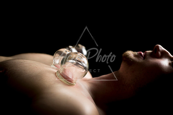 acupuncture-221