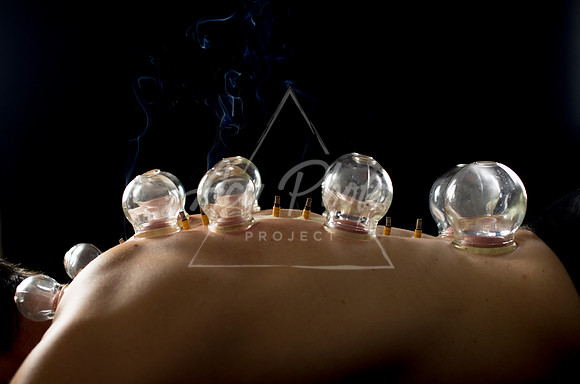 acupuncture-280