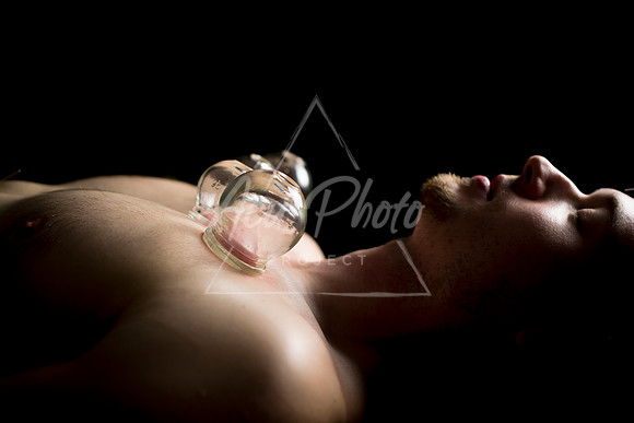 acupuncture-223