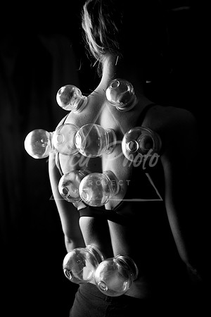 acupuncture-303