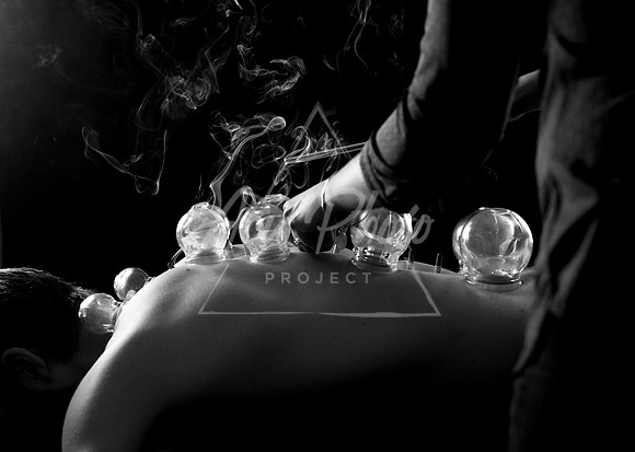 acupuncture-255