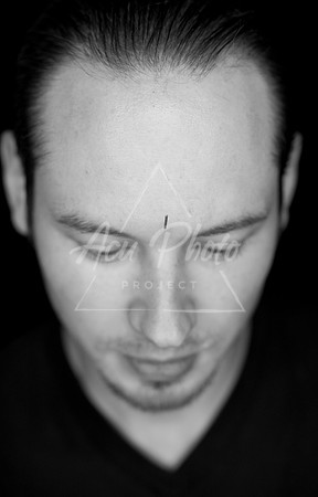 acupuncture-349