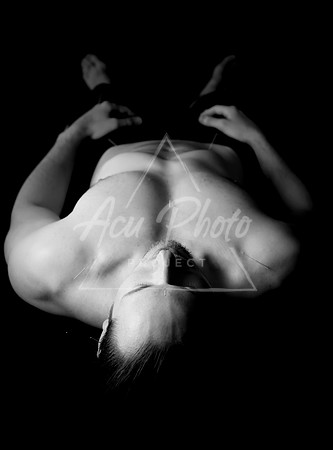 acupuncture-173