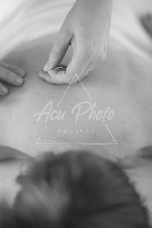 truhealthfit_acupuncture_041