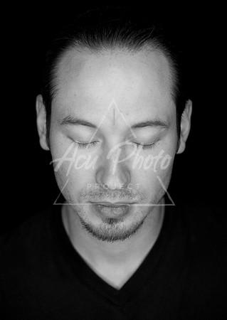 acupuncture-345