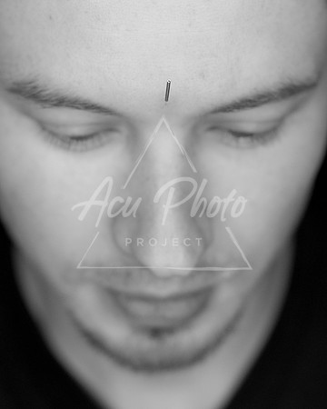 acupuncture-350