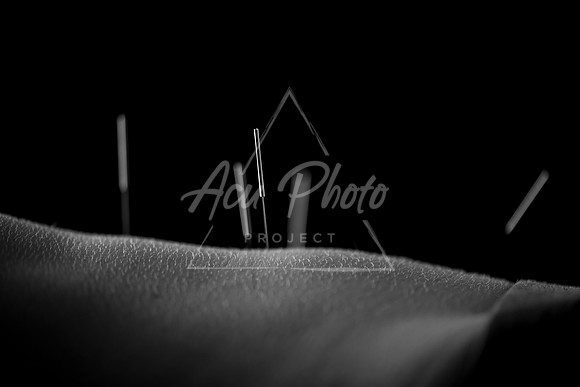 acupuncture-016