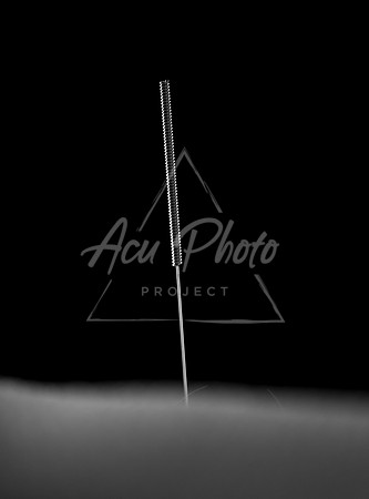 acupuncture-018
