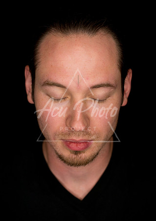 acupuncture-346
