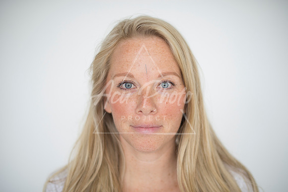 truhealthfit_acupuncture_104