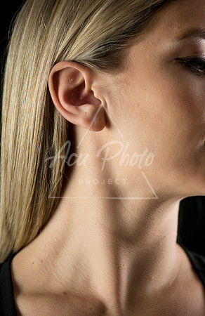 acupuncture project2_060