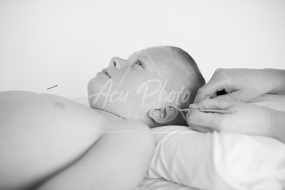 truhealthfit_acupuncture_123