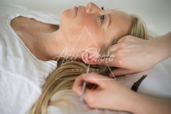 truhealthfit_acupuncture_102