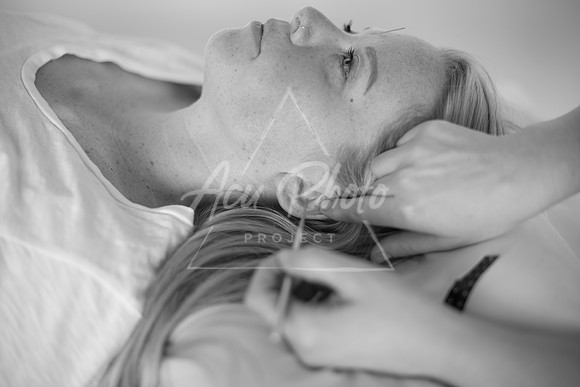 truhealthfit_acupuncture_101