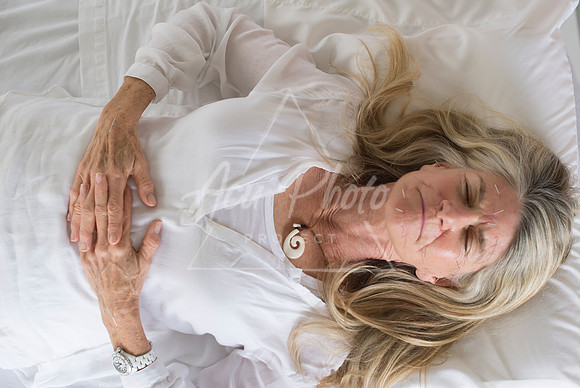 truhealthfit_acupuncture_205