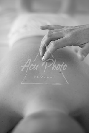 truhealthfit_acupuncture_135