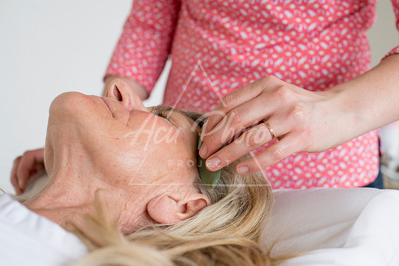 truhealthfit_acupuncture_223
