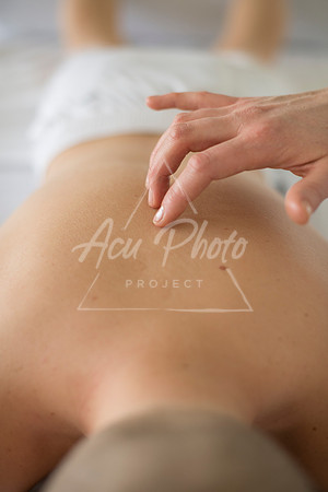 truhealthfit_acupuncture_136