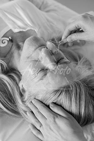 truhealthfit_acupuncture_234