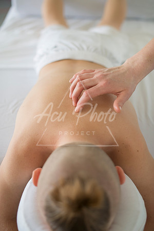 truhealthfit_acupuncture_140