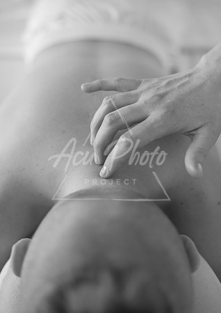 truhealthfit_acupuncture_137
