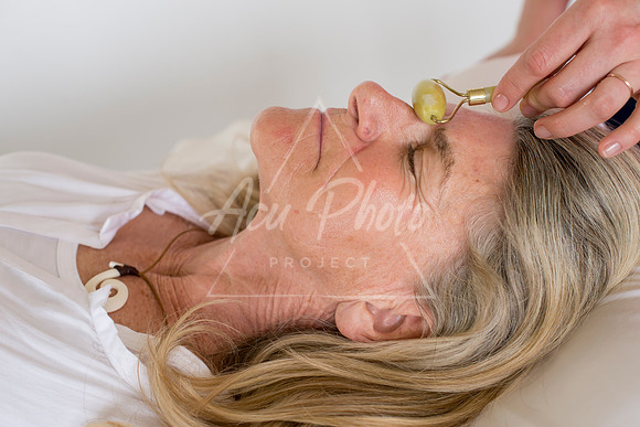 truhealthfit_acupuncture_231