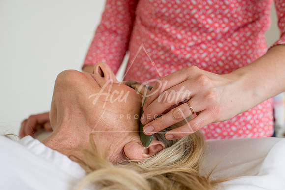 truhealthfit_acupuncture_225