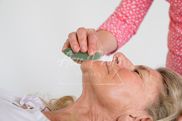 truhealthfit_acupuncture_227