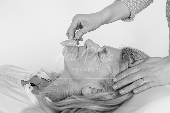 truhealthfit_acupuncture_232