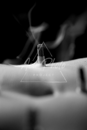 acupuncture-117