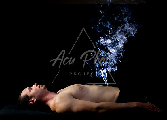 acupuncture-199