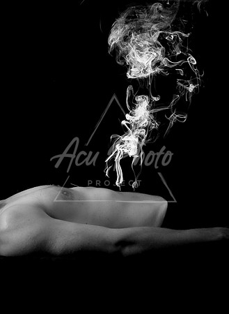 acupuncture-200