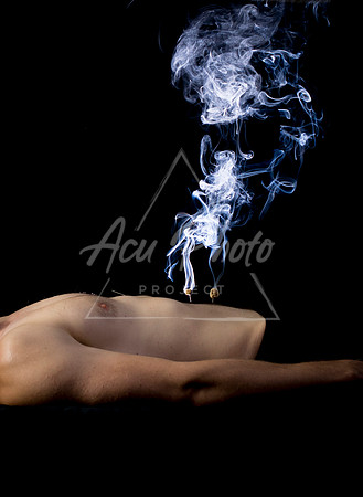 acupuncture-201