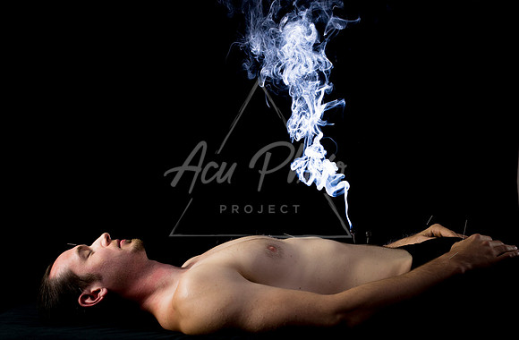 acupuncture-197