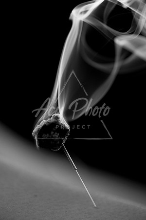 acupuncture-111