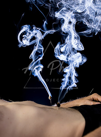 acupuncture-193