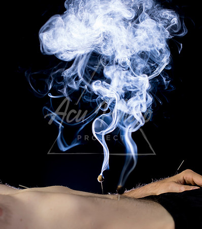 acupuncture-189