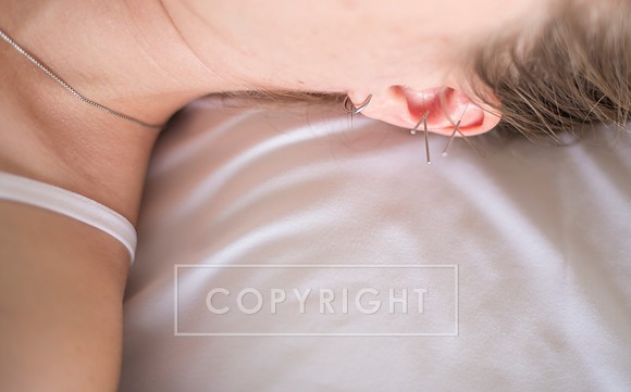 truhealthfit_acupuncture_022